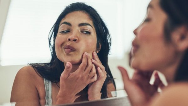 A Brief Guide to Pimple Popping